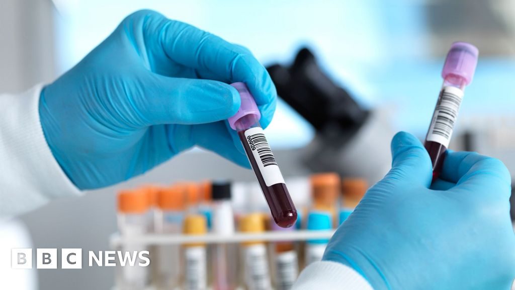 İngiltərə C hepatitini aradan qaldıran ilk ölkələrdən biri olmaq üzrədir